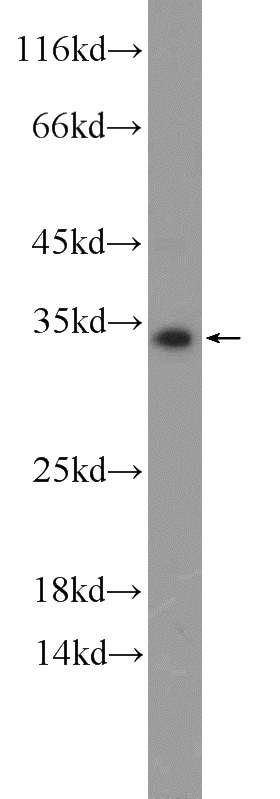 A549 cells were subjected to SDS PAGE followed by western blot with Catalog No:109650(CXorf26 Antibody) at dilution of 1:300