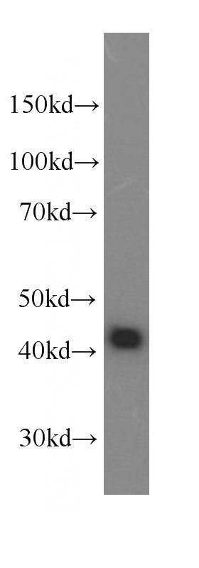 K-562 cells were subjected to SDS PAGE followed by western blot with Catalog No:107618(TDP-43 Antibody) at dilution of 1:10000