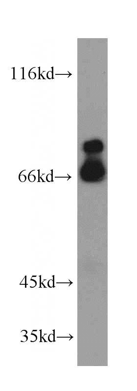 HeLa cells were subjected to SDS PAGE followed by western blot with Catalog No:112559(C10orf119 antibody) at dilution of 1:500