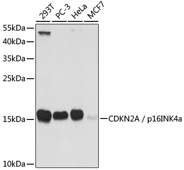 Western blot - CDKN2A / p16INK4a Polyclonal Antibody. Western blot analysis of extracts of various cell lines, using CDKN2A / p16INK4a antibody at 1:1000 dilution.Secondary antibody: HRP Goat Anti-Rabbit IgG at 1:10000 dilution.Lysates/proteins: 25ug per lane.Blocking buffer: 3% nonfat dry milk in TBST.Exposure time: 15s.
