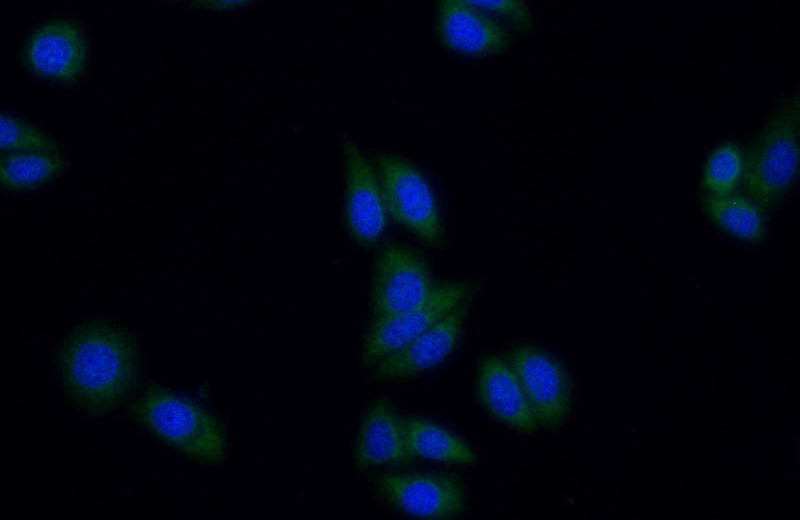 Immunofluorescent analysis of HepG2 cells using Catalog No:117017(ZNF654 Antibody) at dilution of 1:50 and Alexa Fluor 488-congugated AffiniPure Goat Anti-Rabbit IgG(H+L)