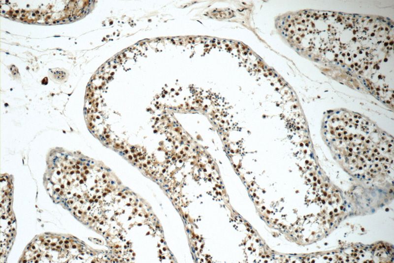 Immunohistochemistry of paraffin-embedded human testis tissue slide using Catalog No:110414(EXOSC8 Antibody) at dilution of 1:50 (under 10x lens)