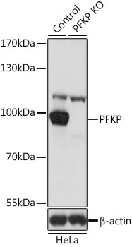Western blot - PFKP Polyclonal Antibody 