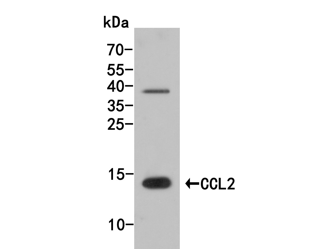 Fig1:; Western blot analysis of CCL2 on mouse testis tissue lysate. Proteins were transferred to a PVDF membrane and blocked with 5% NFDM/TBST for 1 hour at room temperature. The primary antibody ( 1/500) was used in 5% NFDM/TBST at room temperature for 2 hours. Goat Anti-Rabbit IgG - HRP Secondary Antibody (HA1001) at 1:200,000 dilution was used for 1 hour at room temperature.