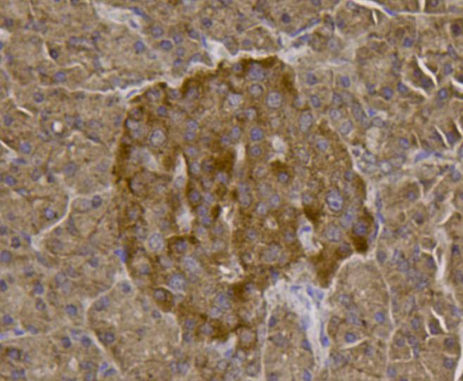 Fig3: Immunohistochemical analysis of paraffin- embedded human pancreas tissue using anti-TMEM39a rabbit polyclonal antibody.