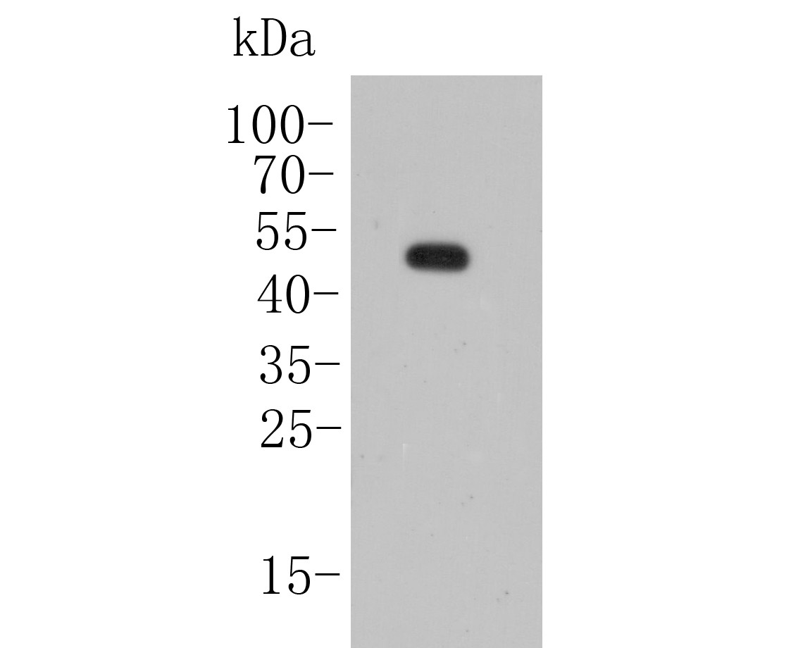 Fig1:; Western blot analysis of KCNK2 on rat brain lysate. Proteins were transferred to a PVDF membrane and blocked with 5% BSA in PBS for 1 hour at room temperature. The primary antibody ( 1/500) was used in 5% BSA at room temperature for 2 hours. Goat Anti-Rabbit IgG - HRP Secondary Antibody (HA1001) at 1:5,000 dilution was used for 1 hour at room temperature.
