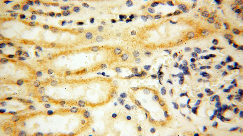 Immunohistochemical of paraffin-embedded human kidney using Catalog No:112848(MRPS21 antibody) at dilution of 1:100 (under 40x lens)
