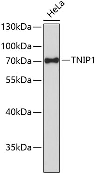Western blot - TNIP1 Polyclonal Antibody 