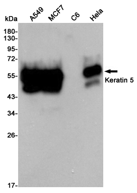 Western blot analysis of extracts from A549,MCF7,C6 and Hela cell lysates using Keratin 5 mouse mAb (1:2000 diluted).Predicted band size:62KDa.Observed band size:62KDa.