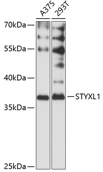 Western blot - STYXL1 Polyclonal Antibody 
