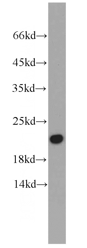 human heart tissue were subjected to SDS PAGE followed by western blot with Catalog No:108829(CALML6 antibody) at dilution of 1:500