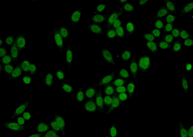 Immunofluorescent analysis of HeLa cells using Catalog No:109771(DDB2 Antibody) at dilution of 1:50 and Alexa Fluor 488-congugated AffiniPure Goat Anti-Rabbit IgG(H+L)