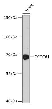 Western blot - CCDC61 Polyclonal Antibody 