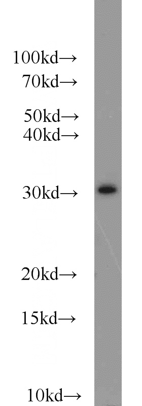 A431 cells were subjected to SDS PAGE followed by western blot with Catalog No:115796(STX2 antibody) at dilution of 1:800