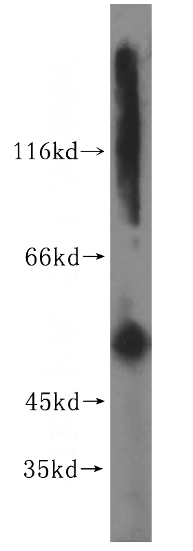 A431 cells were subjected to SDS PAGE followed by western blot with Catalog No:109808(KRT6-specific antibody) at dilution of 1:300