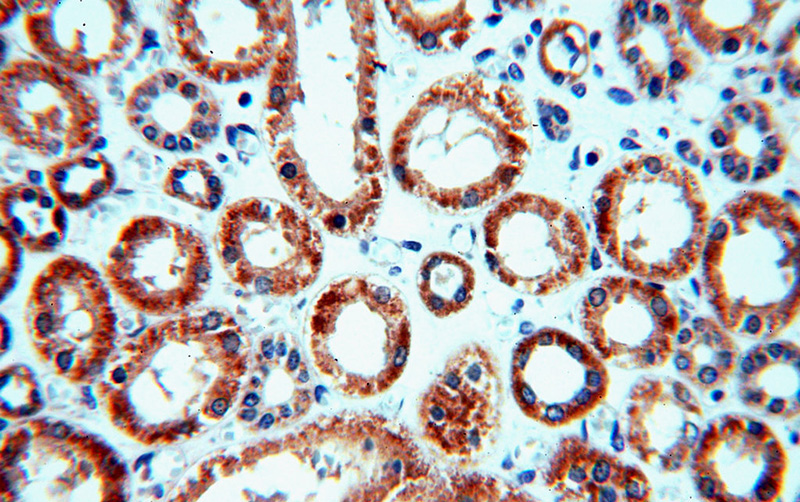 Immunohistochemical of paraffin-embedded human kidney using Catalog No:113080(NDUFC2 antibody) at dilution of 1:400 (under 40x lens)
