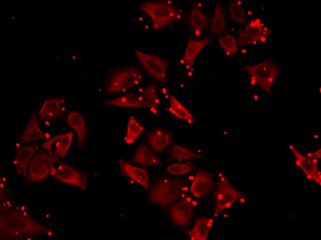 Immunofluorescence - SLC23A2 Polyclonal Antibody 