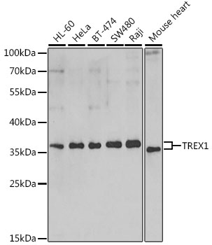 Western blot - TREX1 Polyclonal Antibody 
