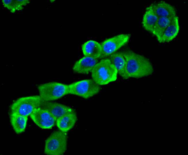 Fig2: Immunocytochemical staining of PANC-1 cells using anti-CCL3 rabbit polyclonal antibody.