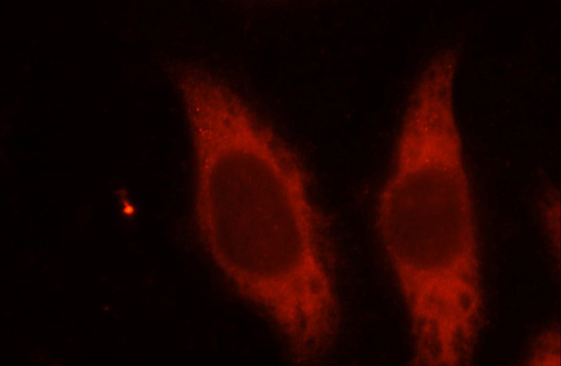 Immunofluorescent analysis of MCF-7 cells, using TBC1D17 antibody Catalog No:115862 at 1:50 dilution and Rhodamine-labeled goat anti-rabbit IgG (red).