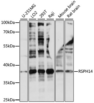 Western blot - RSPH14 Polyclonal Antibody 