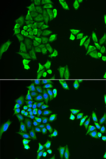 Immunofluorescence - ACSS2 Polyclonal Antibody 