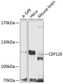 Western blot - CEP120 Polyclonal Antibody 
