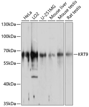 Western blot - KRT9 Polyclonal Antibody 