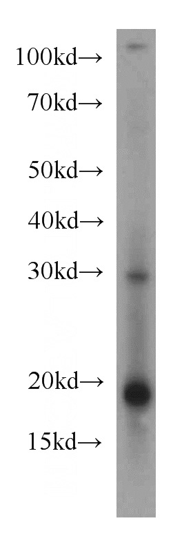 Jurkat cells were subjected to SDS PAGE followed by western blot with Catalog No:114749(RNF181 antibody) at dilution of 1:500