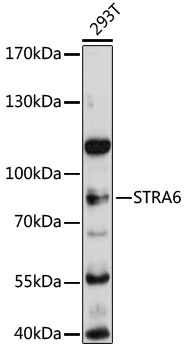 Western blot - STRA6 Polyclonal Antibody 