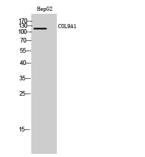 Fig1:; Western Blot analysis of HepG2 cells using COL9A1 Polyclonal Antibody