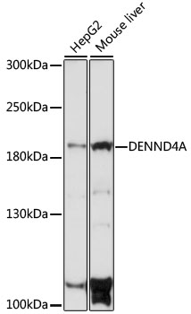 Western blot - DENND4A Polyclonal Antibody 