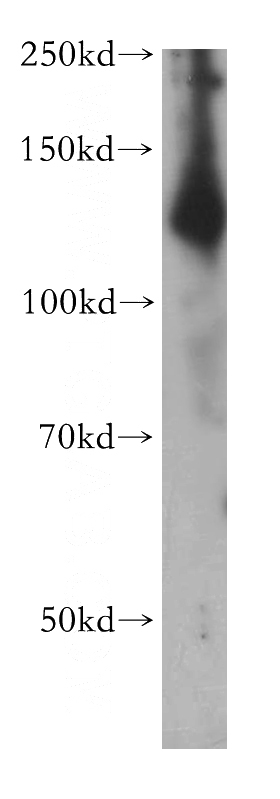 human brain tissue were subjected to SDS PAGE followed by western blot with Catalog No:107781(ADCY6 antibody) at dilution of 1:200