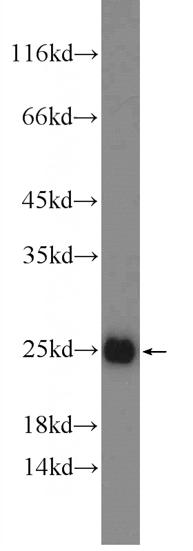 mouse colon tissue were subjected to SDS PAGE followed by western blot with Catalog No:114152(PPP1R14D Antibody) at dilution of 1:1000