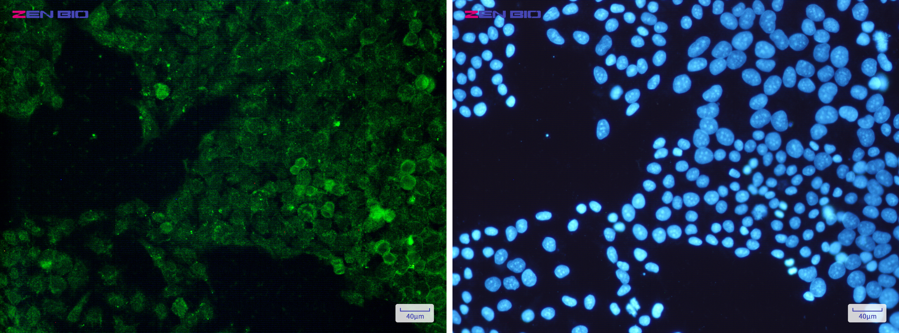 Immunocytochemistry of Cytochrome P450 Reductase(green) in Hela cells using Cytochrome P450 Reductase Rabbit pAb at dilution 1/50, and DAPI(blue)
