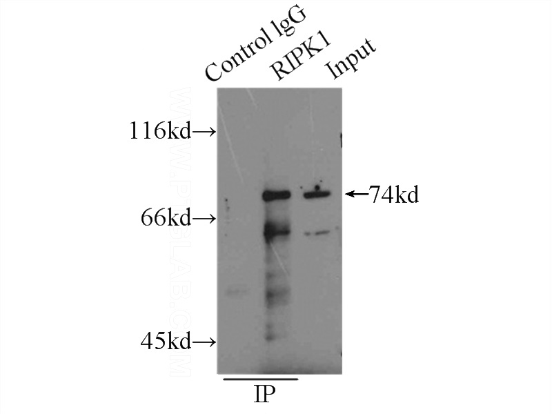 IP Result of anti-RIPK1-Specific (IP:Catalog No:114715, 4ug; Detection:Catalog No:114715 1:300) with HeLa cells lysate 2000ug.