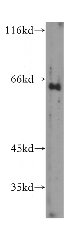 human brain tissue were subjected to SDS PAGE followed by western blot with Catalog No:111232(GTF2H1 antibody) at dilution of 1:200