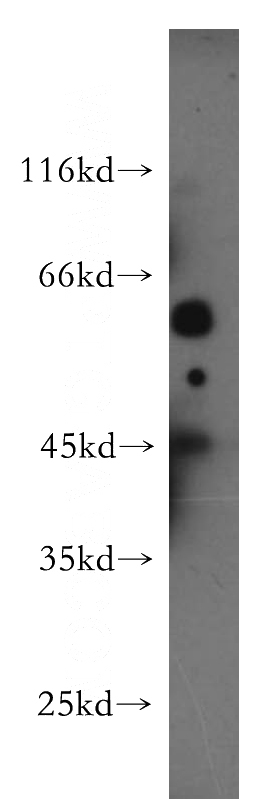 HepG2 cells were subjected to SDS PAGE followed by western blot with Catalog No:111298(HERPUD1 antibody) at dilution of 1:600