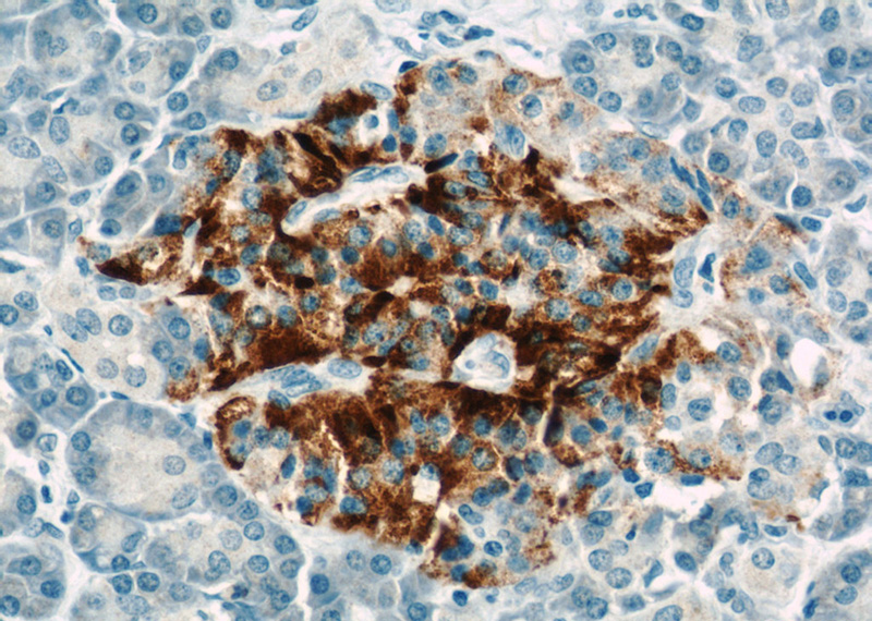 Immunohistochemical of paraffin-embedded human pancreas using Catalog No:116273(TMED10 antibody) at dilution of 1:50 (under 40x lens)