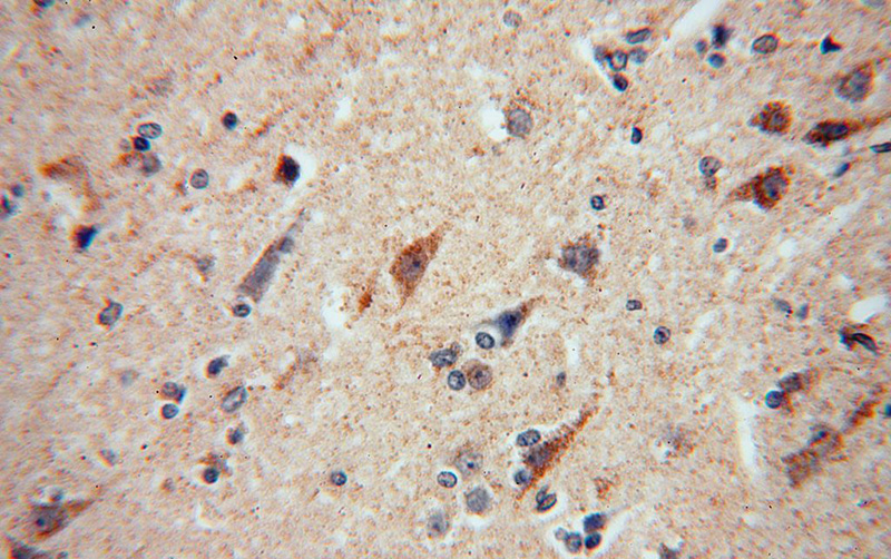 Immunohistochemical of paraffin-embedded human brain using Catalog No:113061(NDUFA5 antibody) at dilution of 1:50 (under 40x lens)