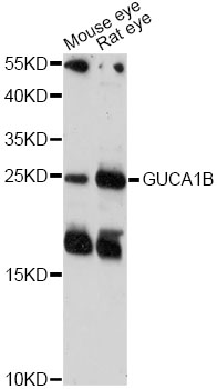 Western blot - GUCA1B Polyclonal Antibody 