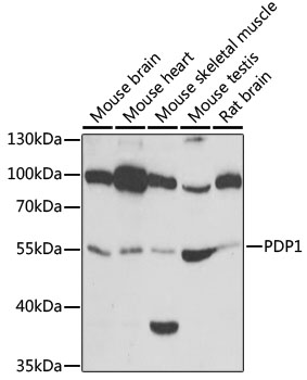 Western blot - PDP1 Polyclonal Antibody 