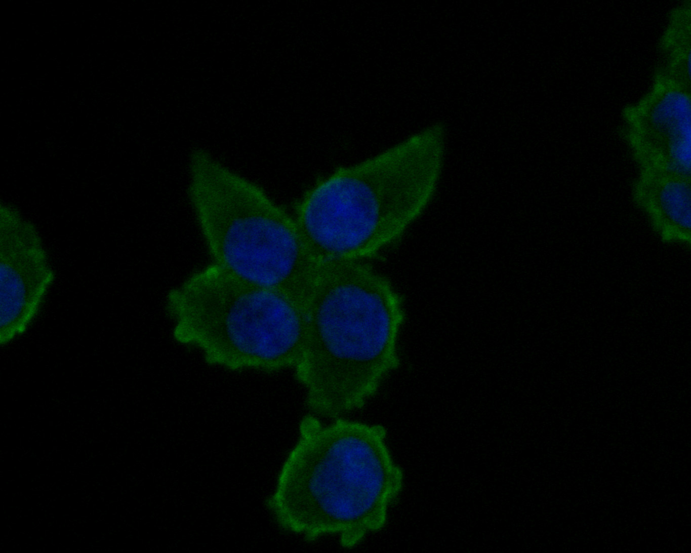 Fig3:; ICC staining of Alpha-2-macroglobulin in Hela cells (green). Formalin fixed cells were permeabilized with 0.1% Triton X-100 in TBS for 10 minutes at room temperature and blocked with 1% Blocker BSA for 15 minutes at room temperature. Cells were probed with the primary antibody ( 1/50) for 1 hour at room temperature, washed with PBS. Alexa Fluor®488 Goat anti-Rabbit IgG was used as the secondary antibody at 1/1,000 dilution. The nuclear counter stain is DAPI (blue).