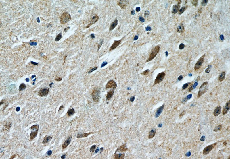 Immunohistochemistry of paraffin-embedded mouse brain tissue slide using Catalog No:110703(FOXO1 Antibody) at dilution of 1:200 (under 40x lens)