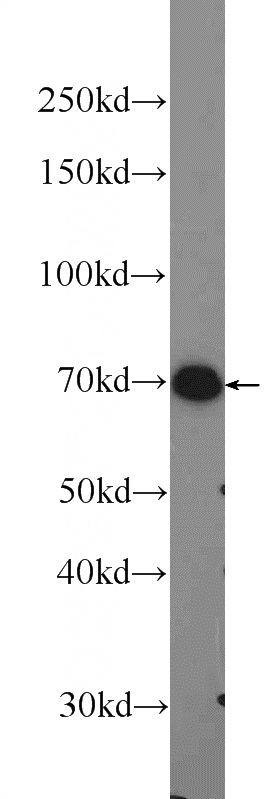 U-937 cells were subjected to SDS PAGE followed by western blot with Catalog No:114164(PRAM1 Antibody) at dilution of 1:300