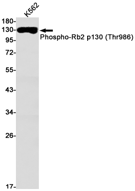 Western blot detection of Phospho-Rb2 p130 (Thr986) in K562 cell lysates using Phospho-Rb2 p130 (Thr986) Rabbit mAb(1:1000 diluted).Predicted band size:128kDa.Observed band size:130kDa.