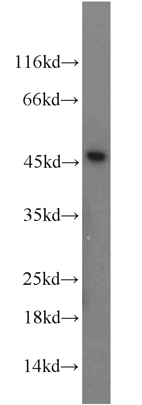 Raji cells were subjected to SDS PAGE followed by western blot with Catalog No:110512(FAM98B antibody) at dilution of 1:1000