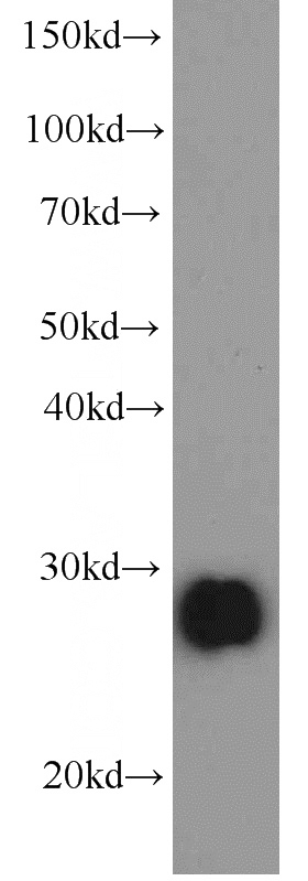 human kidney tissue were subjected to SDS PAGE followed by western blot with Catalog No:107528(APCS antibody) at dilution of 1:1000