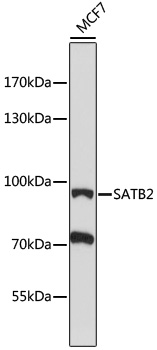 Western blot - SATB2 Polyclonal Antibody 