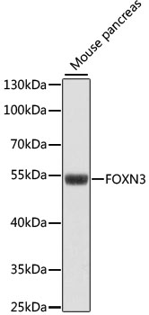 Western blot - FOXN3 Polyclonal Antibody 